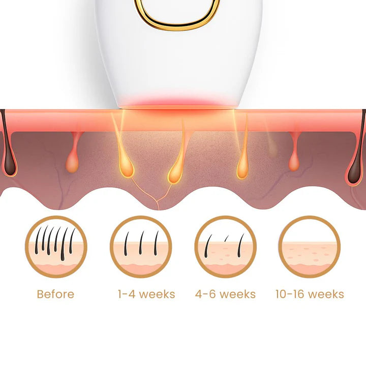 ARQA Laser Hair Removal